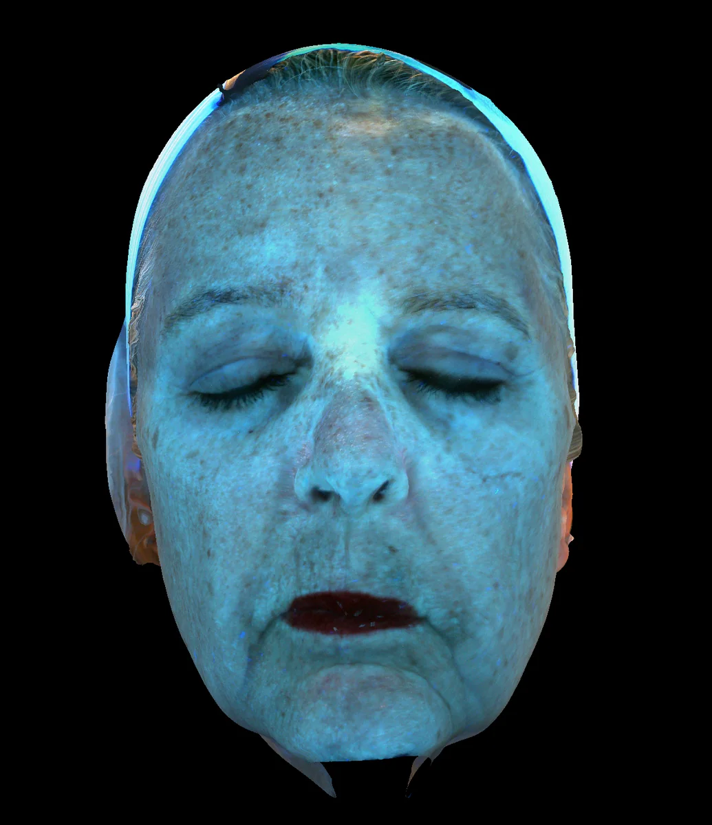 Violet Zone Map diagnostic imaging view