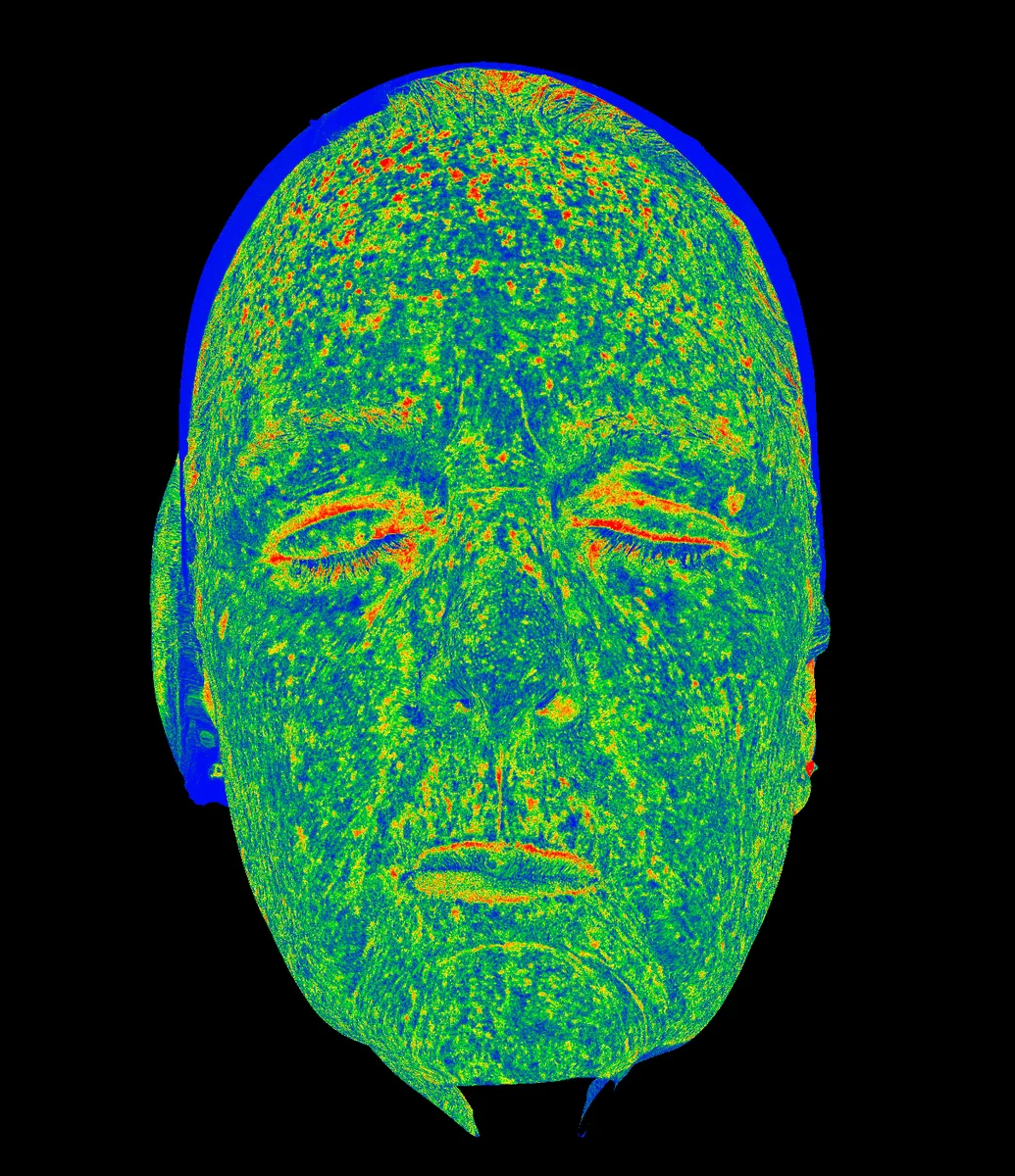 Brown Zone Heat Map diagnostic imaging view