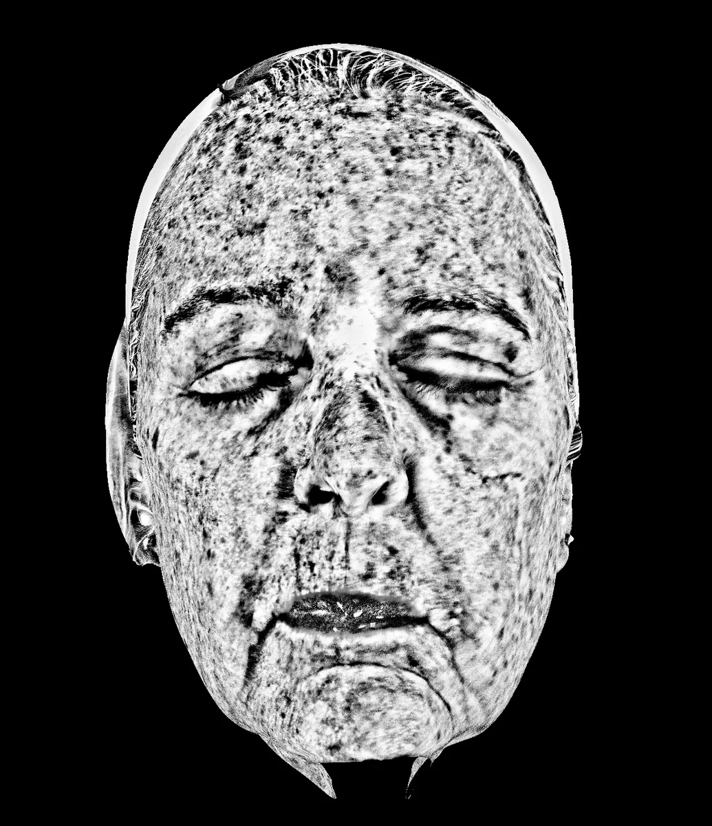 UV Spot diagnostic imaging view