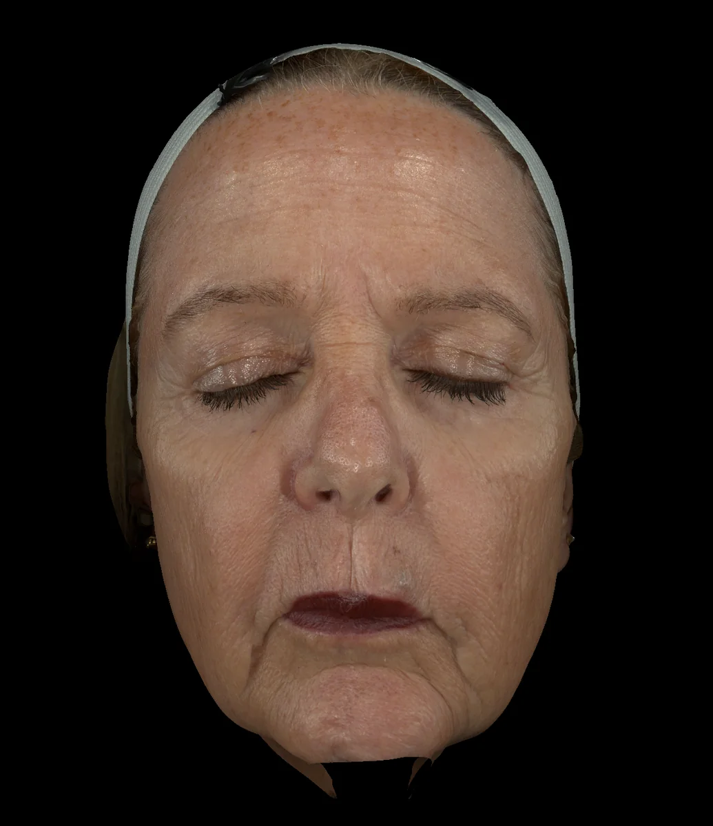 Parallel Polarized diagnostic imaging view