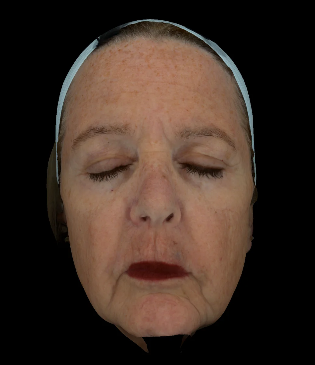 Cross Polarized diagnostic imaging view