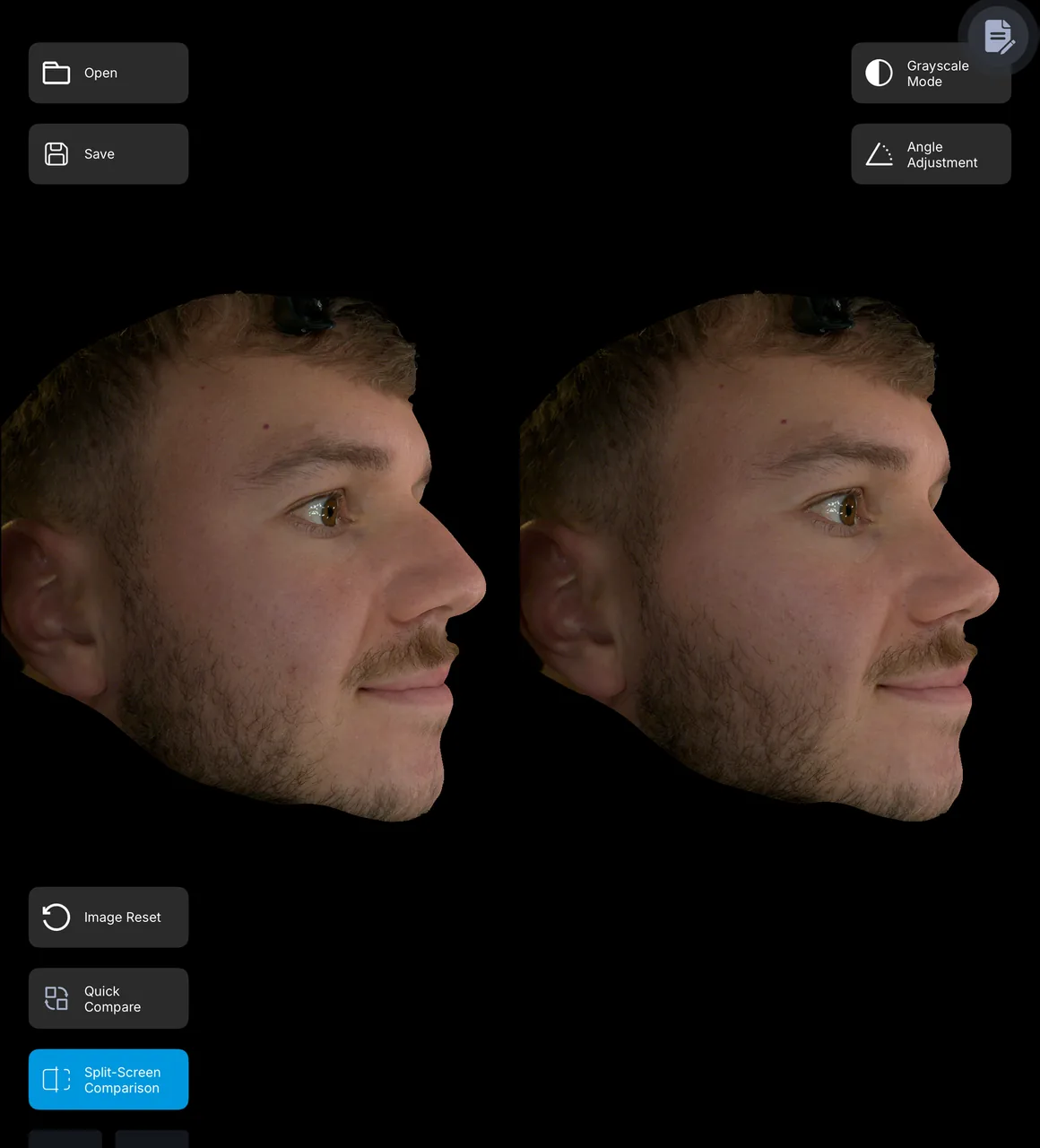 Male baseline and designed profile shown side by side
