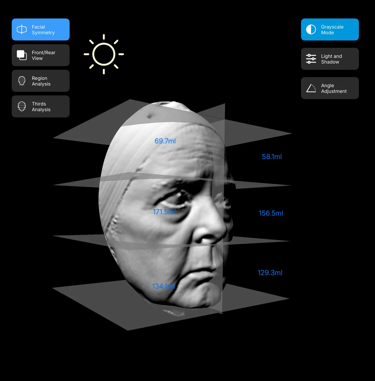 Opposite oblique grayscale facial view with regional volume measurements