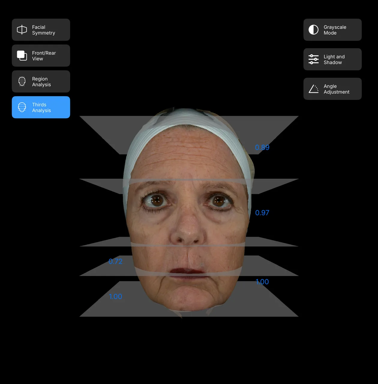 Woman's three-dimensional facial scan with facial thirds analysis