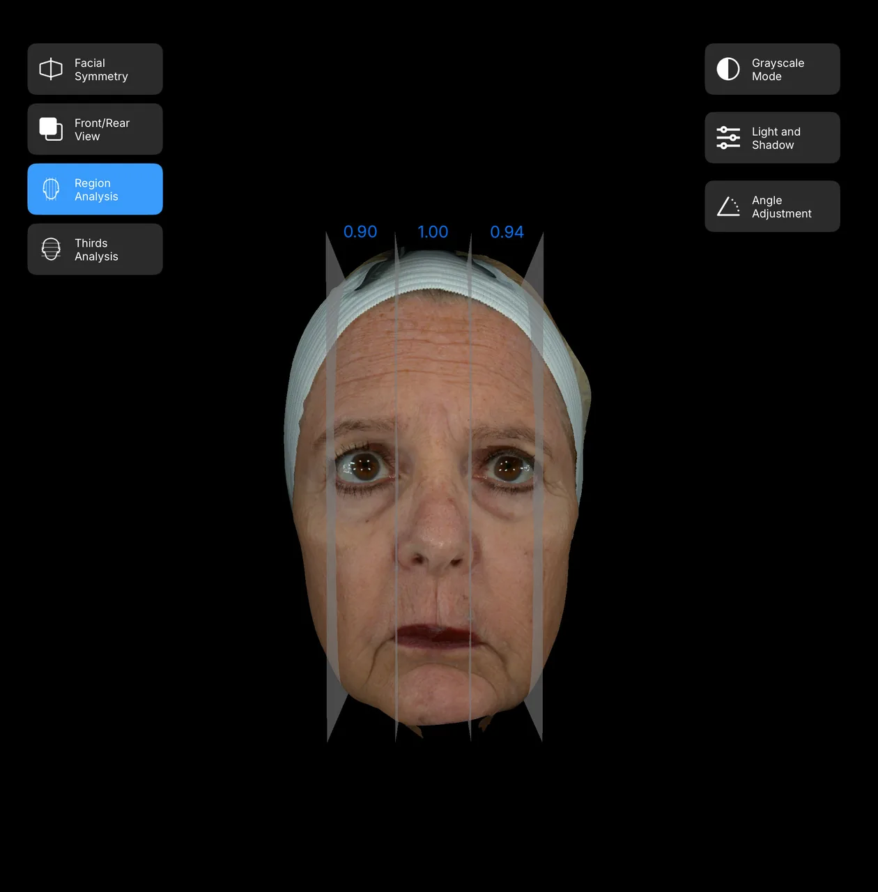 Woman's three-dimensional facial scan divided into proportional regions