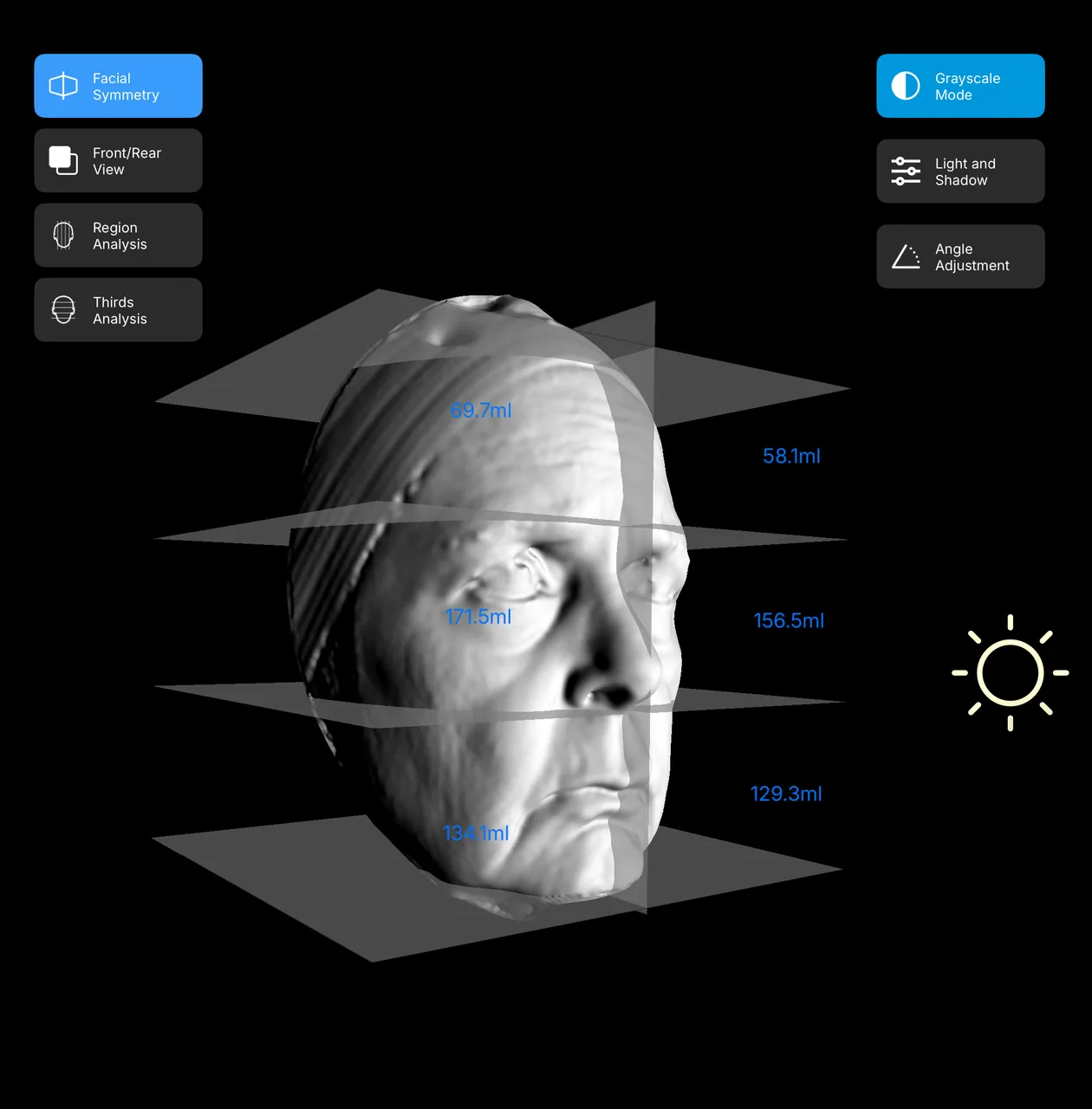 Oblique grayscale facial view with regional volume measurements