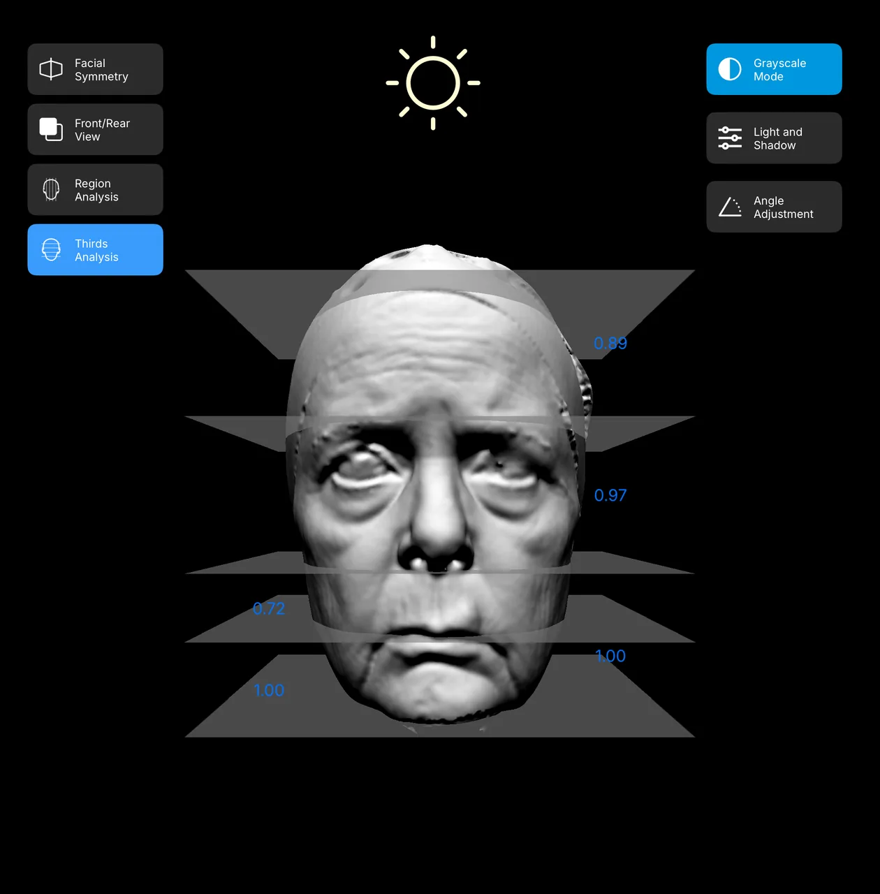 Front grayscale facial surface view showing contour and texture