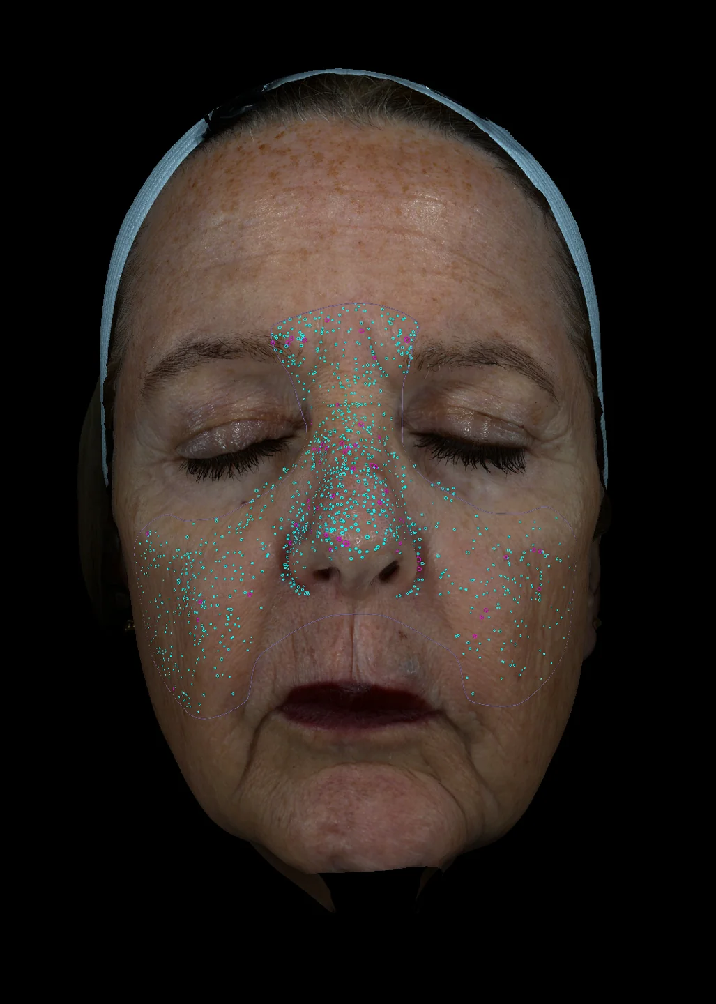 Automated pore analysis overlay