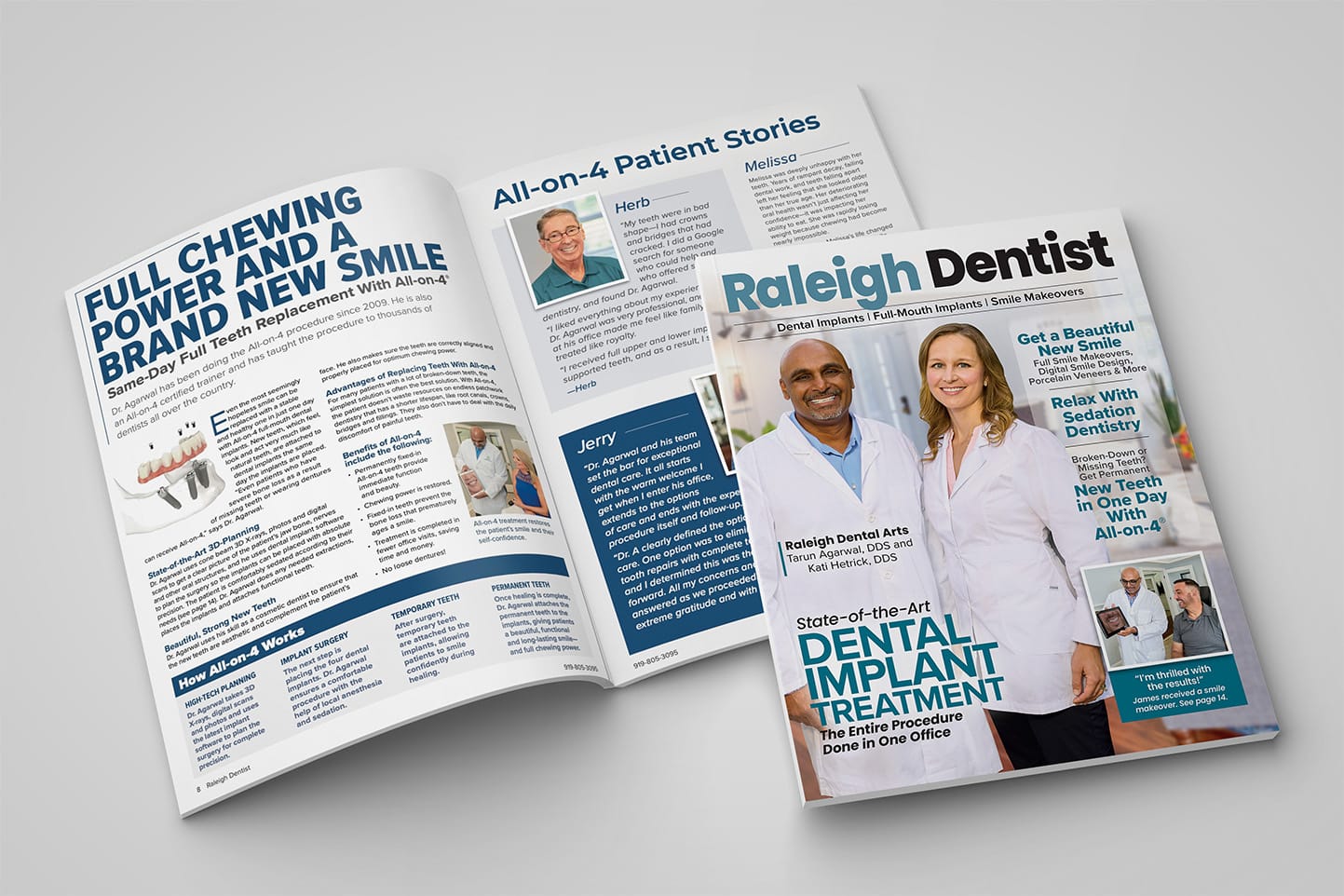 Open magazine spread and cover of Raleigh Dentist featuring dental implant treatment. Cover shows two dentists smiling, Tarun Agarwal and Kati Hetrick. Headlines highlight full smile makeovers, sedation dentistry, and same-day new teeth with All-on-4 implants. Inside pages detail full chewing power, All-on-4 patient stories, 3D planning, benefits of implants, and how the procedure works with photos of oral surgery and patients.