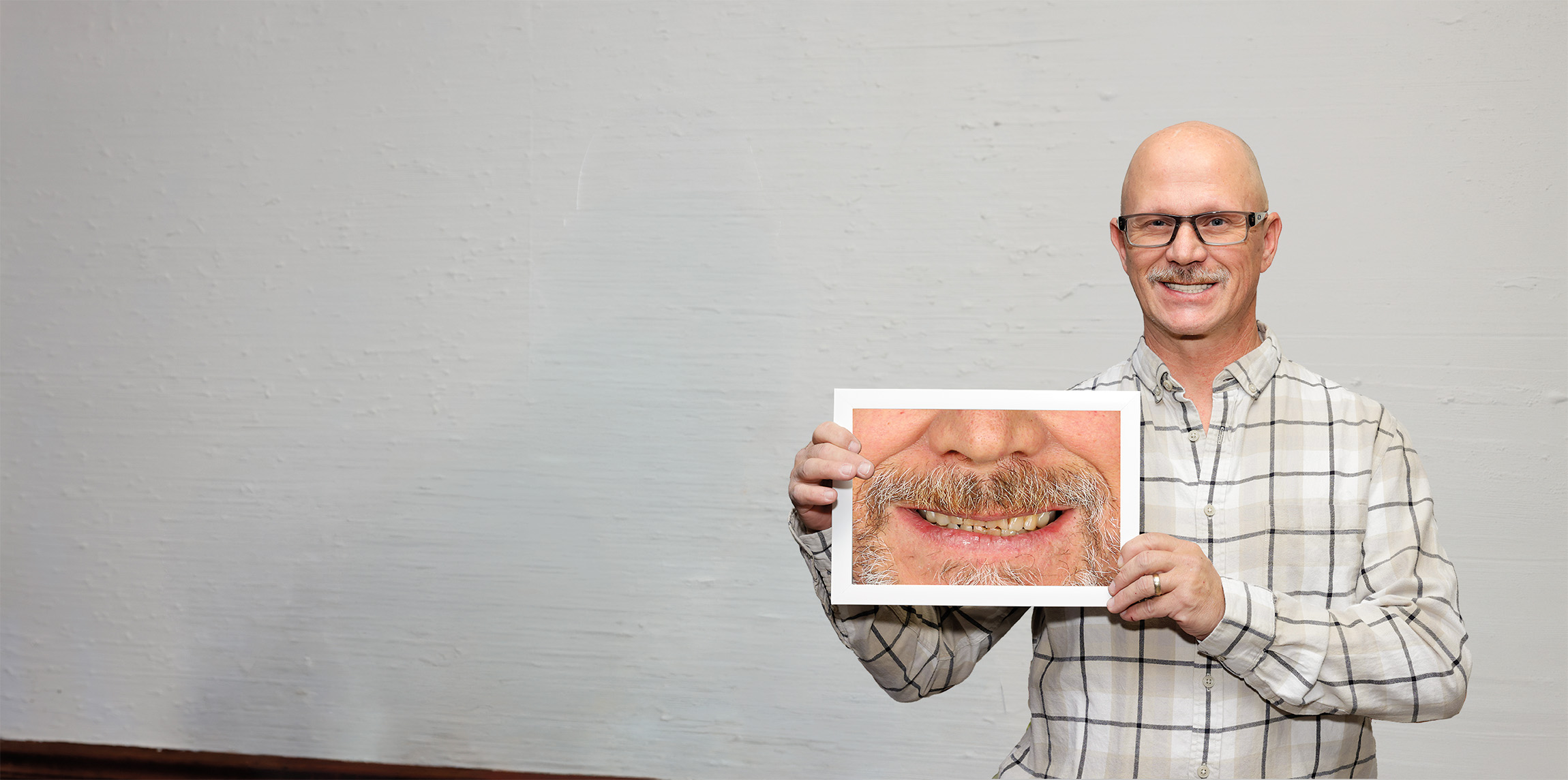 Smiling bald man wearing glasses and a plaid shirt holds a photo close to his chest showing a close-up of a mouth with uneven yellow teeth and facial hair.