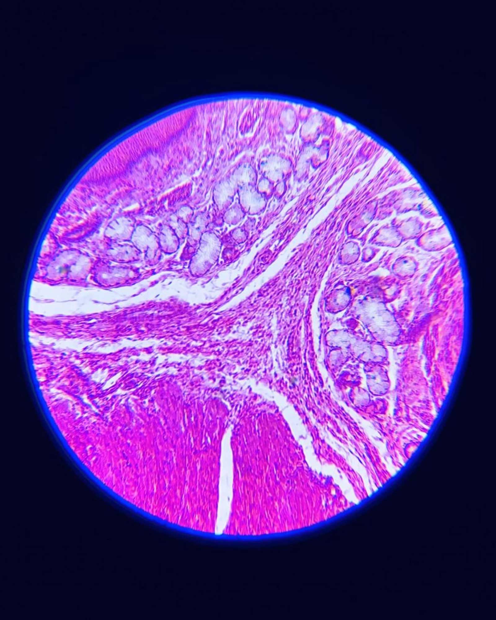 Xaira Therapeutics Launches X-Cell, Its First Virtual Cell Model, Trained on the Largest-Ever Genome-Wide Perturbation Dataset, X-Atlas/Pisces
