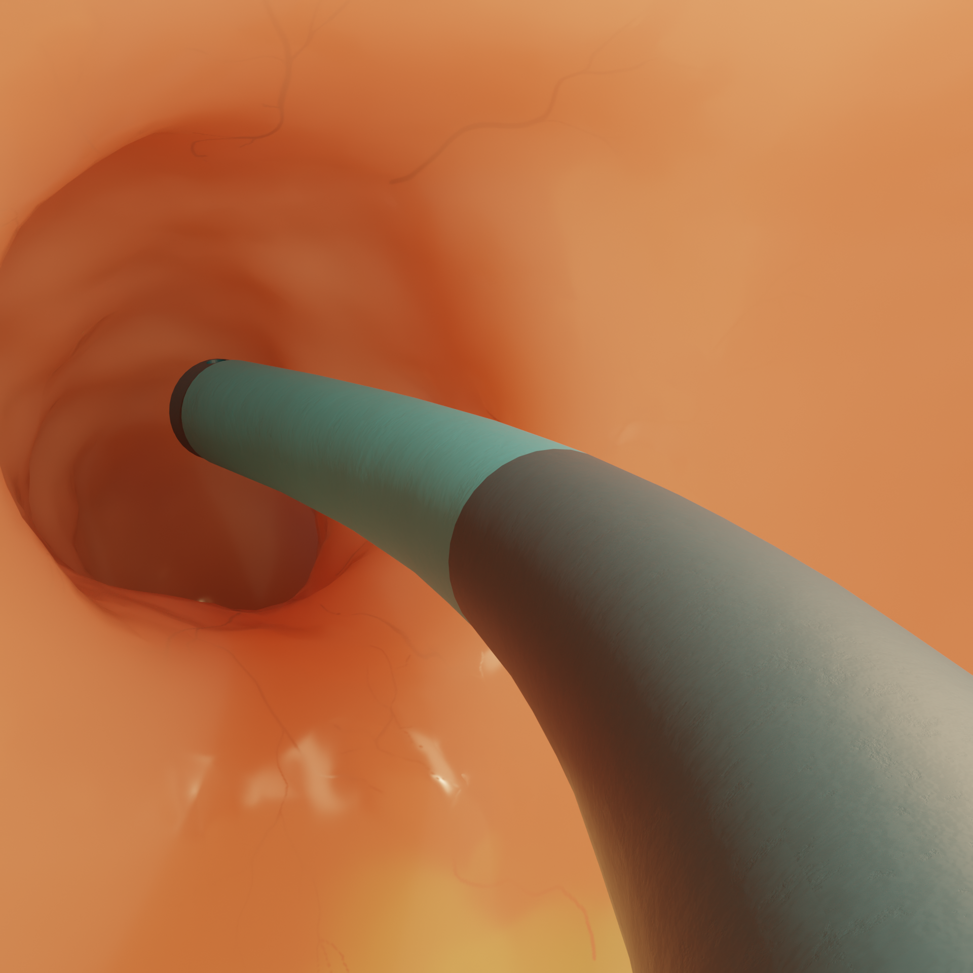 Medical endoscope inserted into an orange-toned tubular organ interior.
