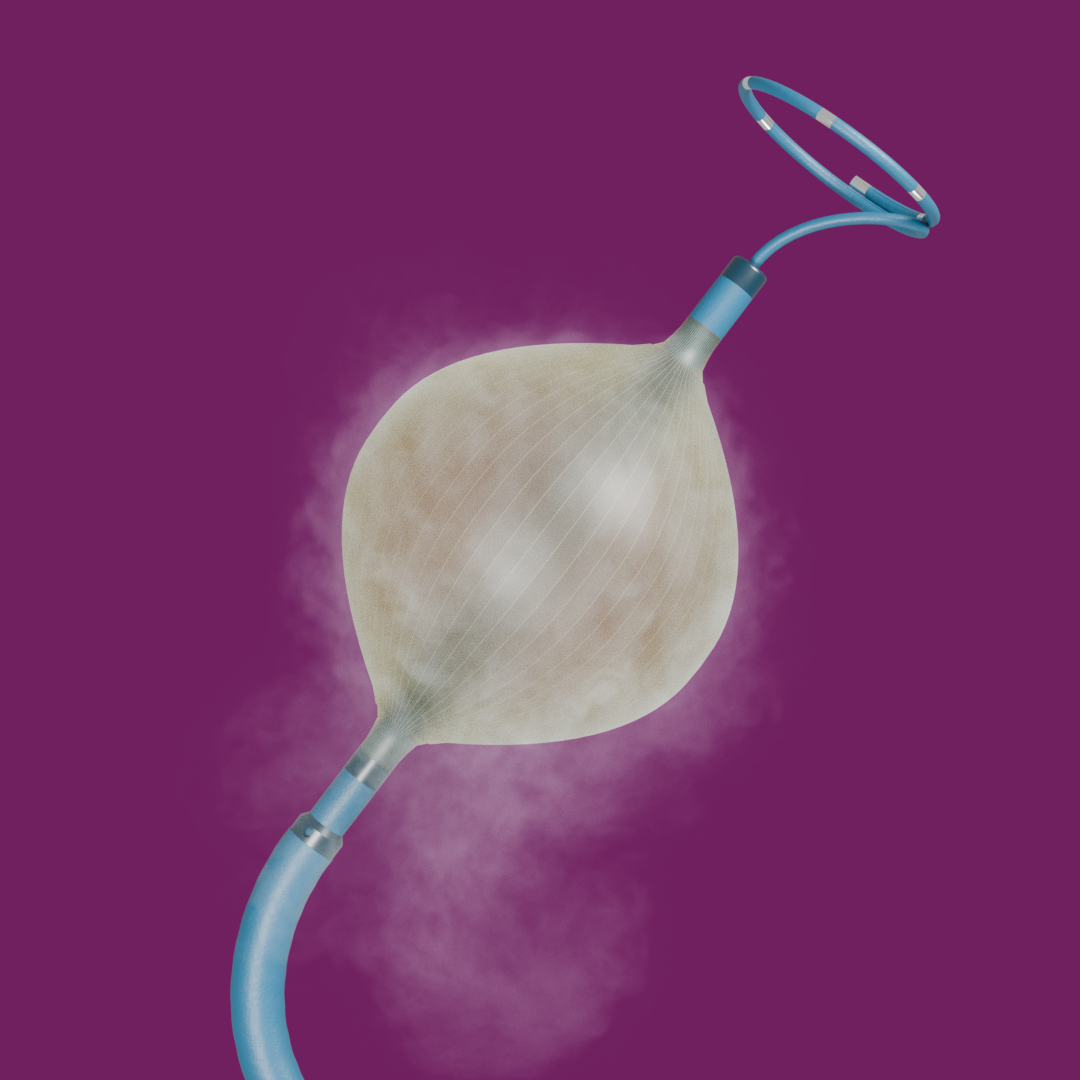 A medical balloon catheter inflated with vapor or mist against a purple background.