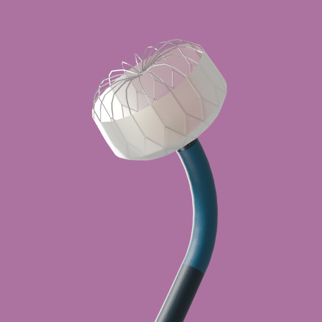 Close-up of a metallic stent device with a wire mesh and silicone cover on a curved handle.