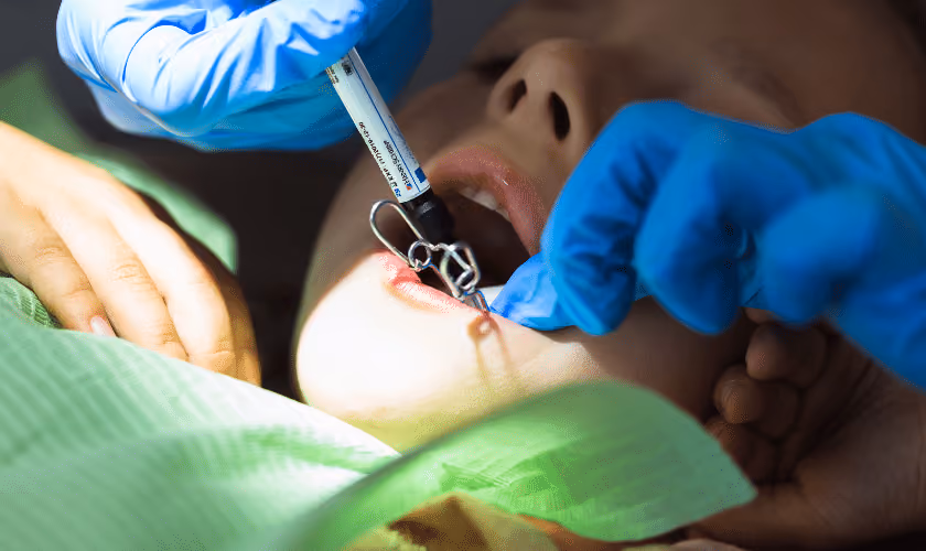 Why You Shouldn’t Skip Your Regular Fluoride Cleanings