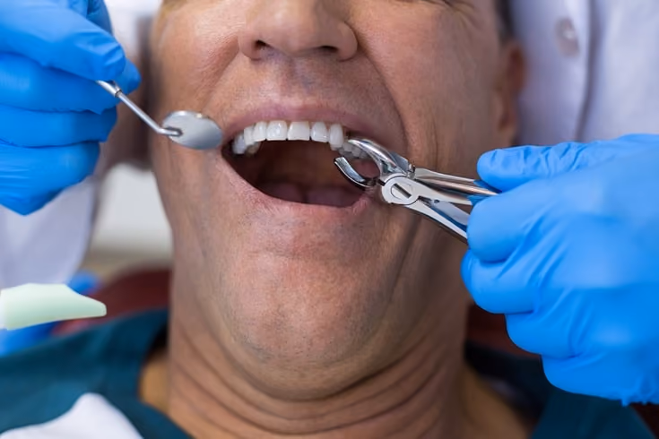 What to expect from immediate Restoration Dentistry?