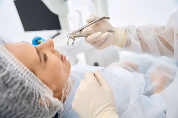 Essential Guide to Tooth Extraction: Benefits, Preparation, and Reasons for Removal