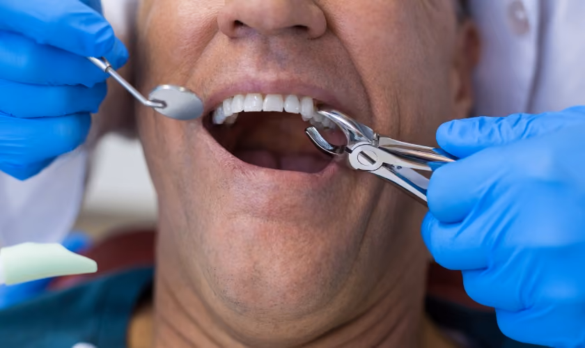 When is a Tooth Extraction Necessary for Orthodontic Treatment?