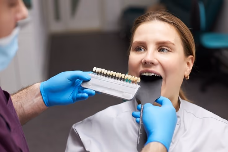 5 Things You Need To Know Before Getting Porcelain Veneers