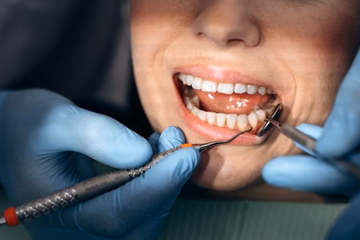 Do Wisdom Tooth Extractions Count As A Dental Emergency?
