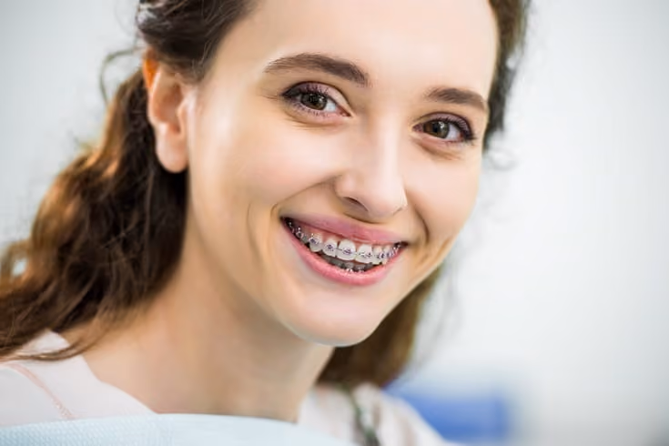 Emerging as a Key Catalyst for Growth in Orthodontics: The Role of Implants