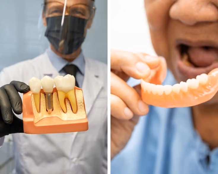 Get A Detailed Comparison Between Dental Implants & Dentures