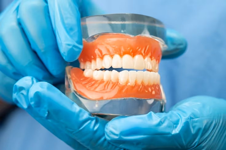 Why Dentures Are a Great Solution for Missing Teeth?