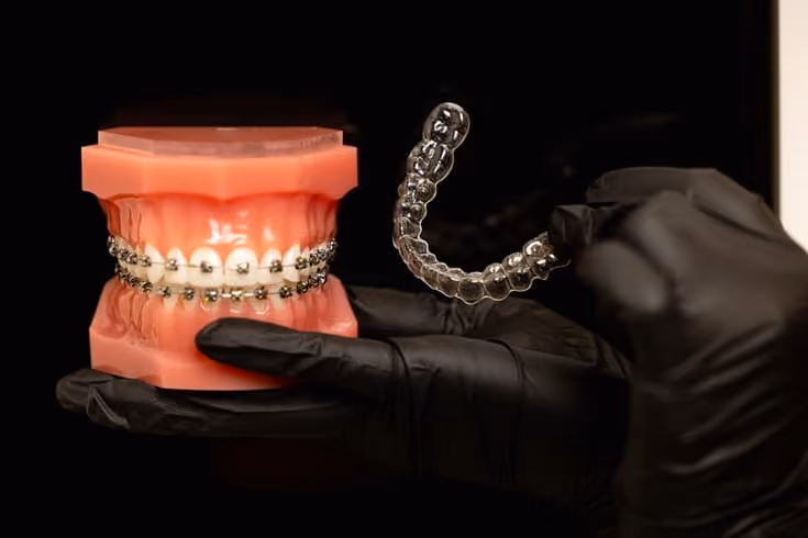 How Invisalign Costs Compare to Traditional Braces