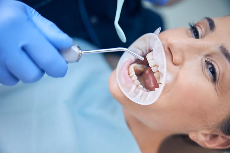 What Happens If I Have a Bone Graft But Not an Implant?