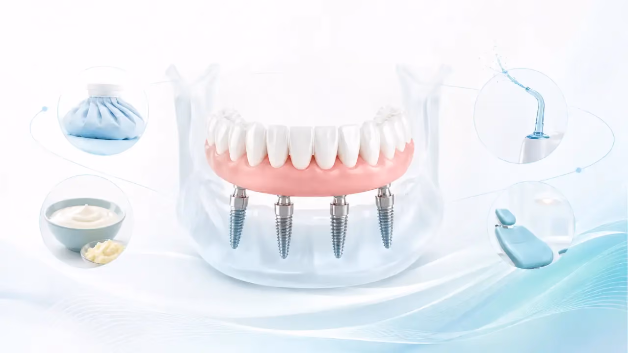 Life After All-on-4 Dental Implants: Recovery, Diet, and Daily Maintenance