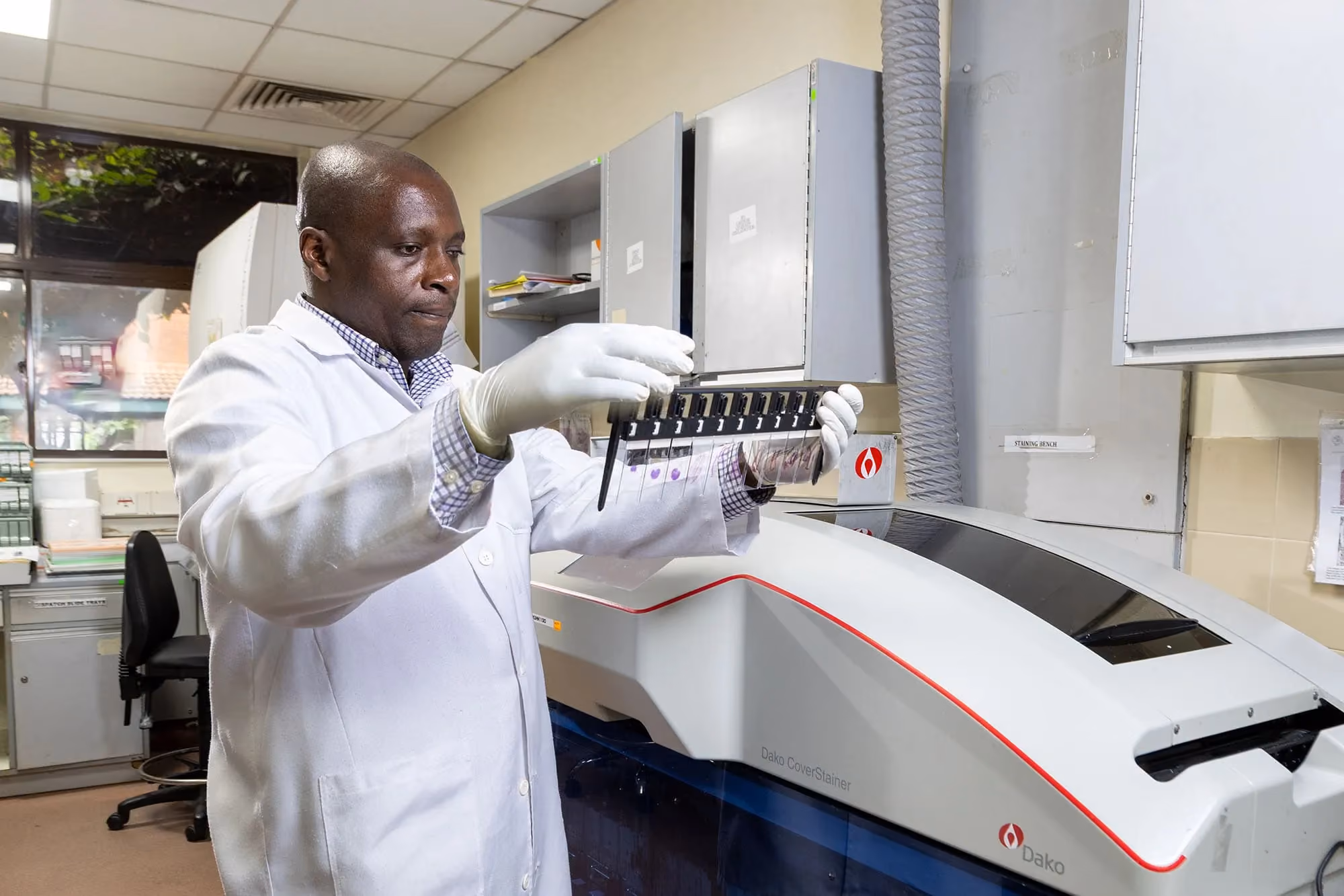 Kenyan researchers test AI’s ability to provide cancer diagnoses