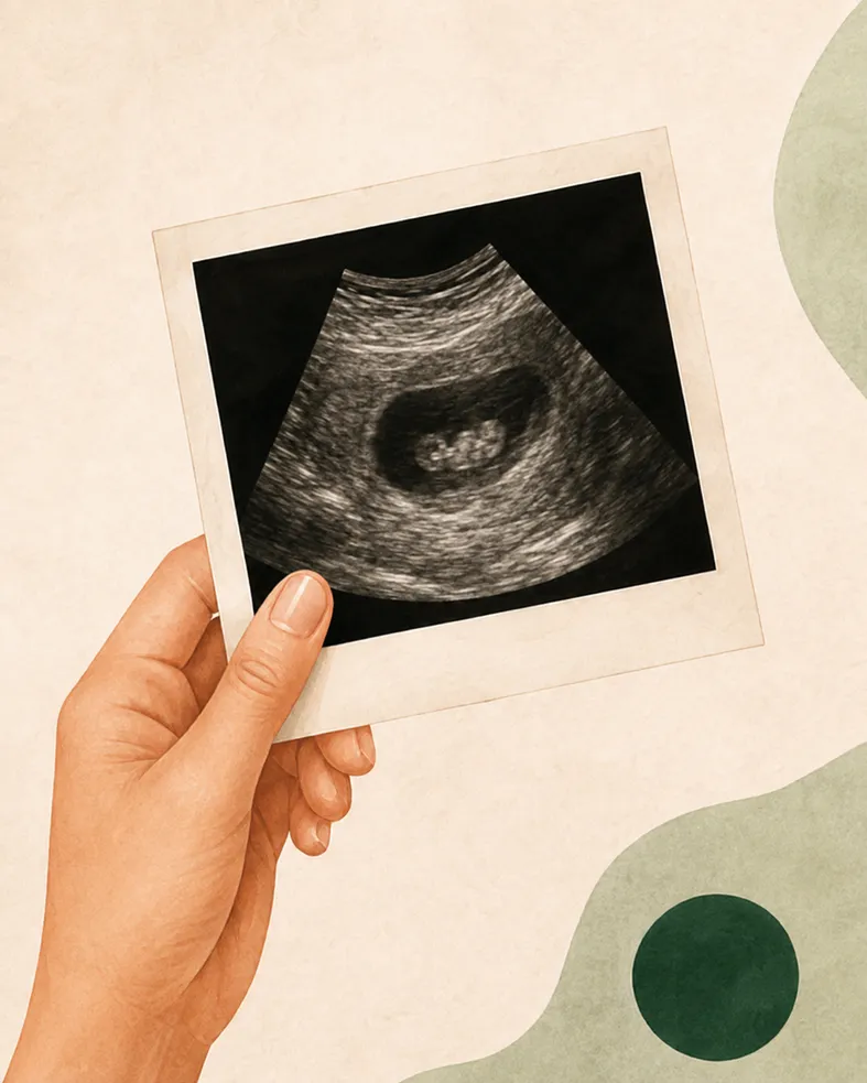 A hand holding a printed ultrasound scan photograph.
