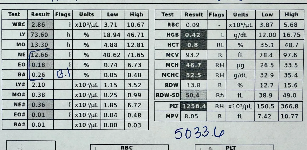 Lab hematology report showing a platelet count of 5,034,000 per microliter used to calculate the 40.272 billion platelet PRP dose