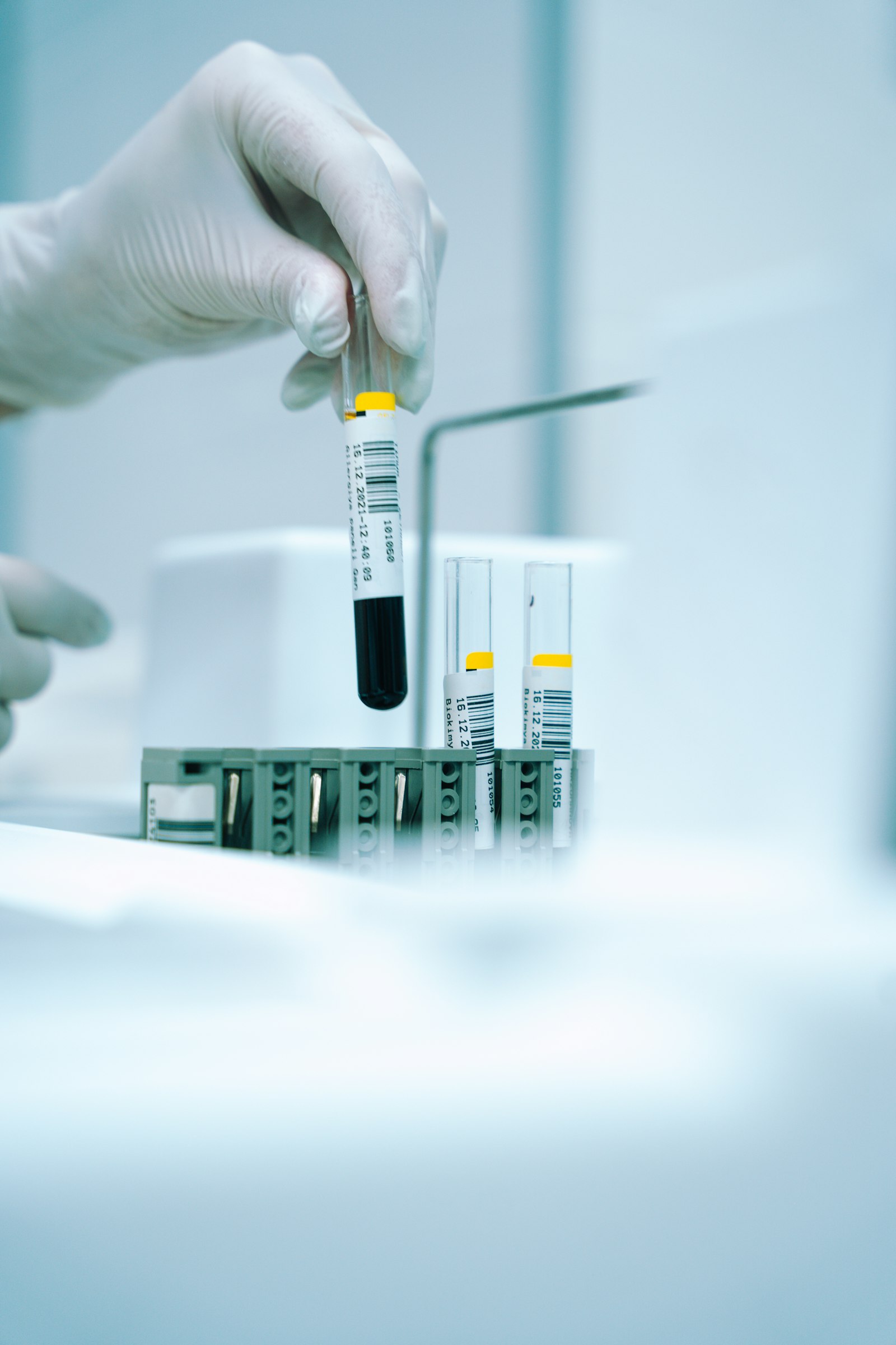 Gloved hand holding a test tube filled with liquid