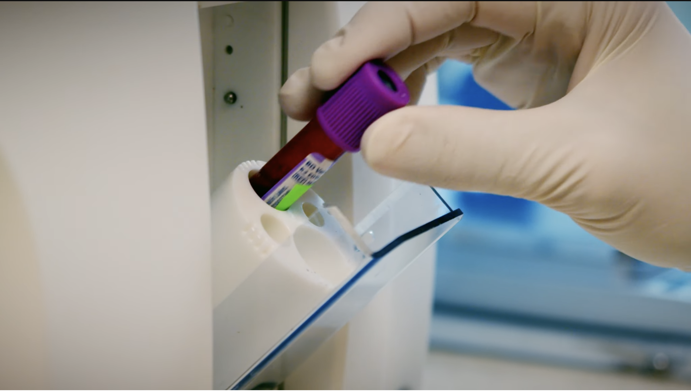 PRP blood tube being placed into a centrifuge