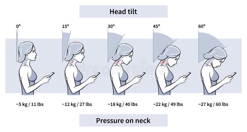 Anatomical illustration of the cervical spine