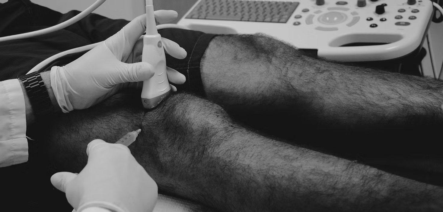 Can PRP Help Hip and Knee Arthritis? What the Evidence Shows from a Double-Board Certified Sports Medicine Physician
