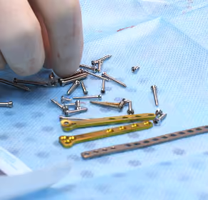 Gloved hand arranging orthopedic screws and metal plates on a blue surgical drape.