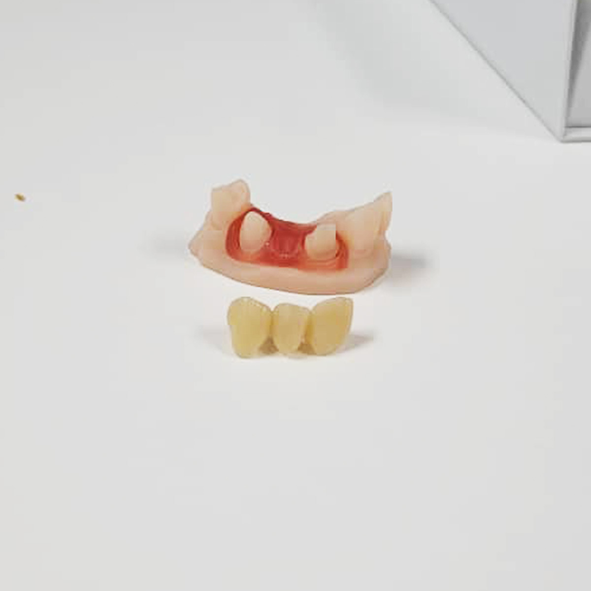 3D Dental Crowns