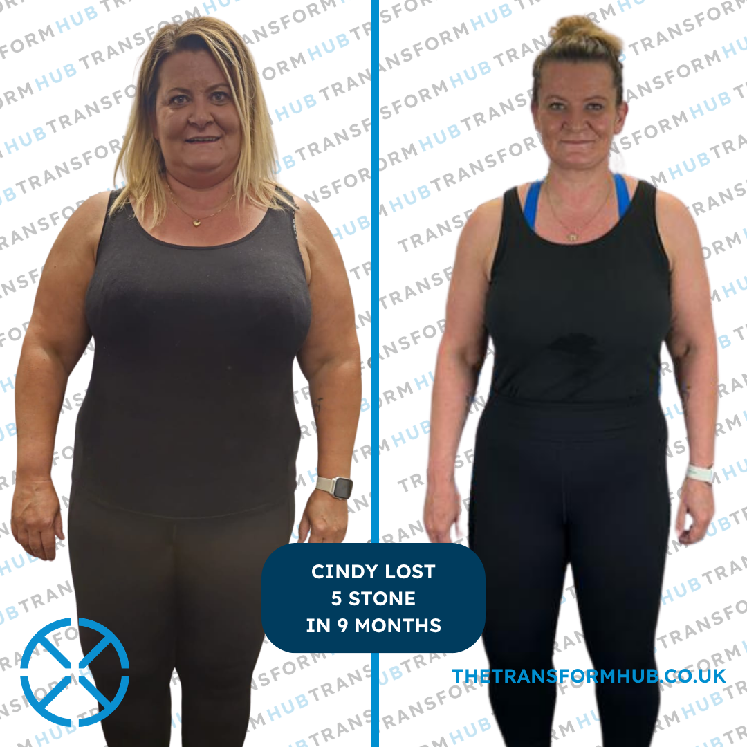 PLACEHOLDER — female client in her 40s before and after transformation photo