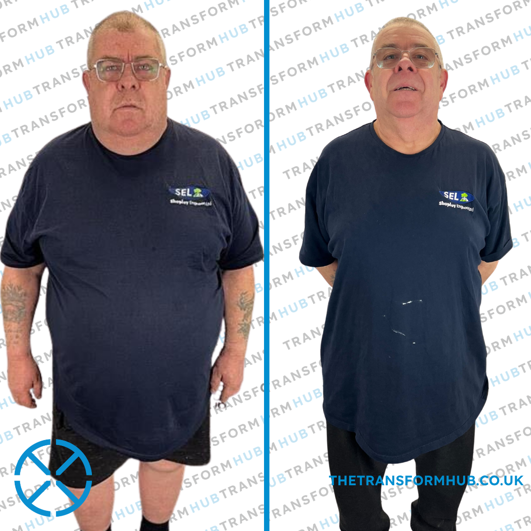 PLACEHOLDER — 40+ female client before and after transformation photo