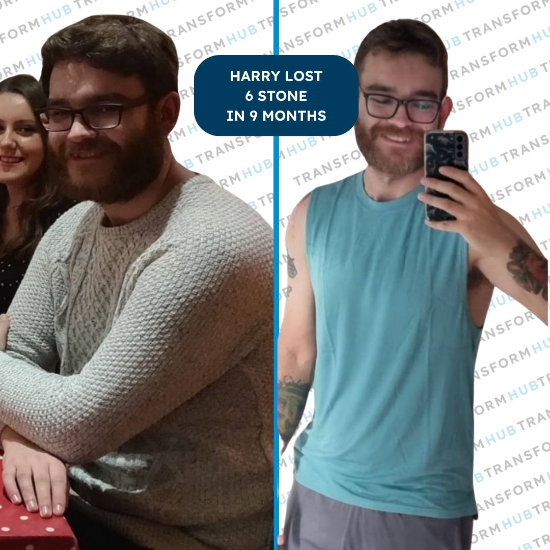 PLACEHOLDER — male client in his 50s before and after transformation photo