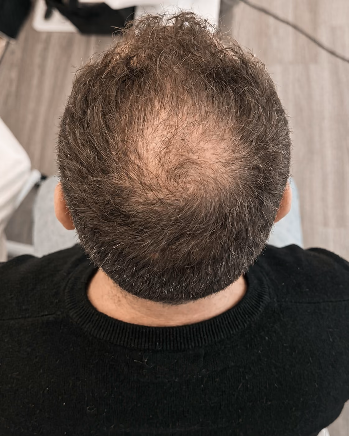 Évaluation capillaire en clinique RACINE