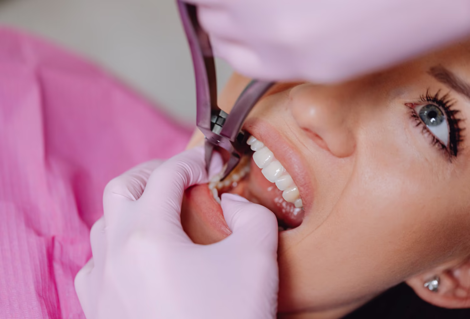 Tooth removal at Seaview Dental in Eatontown, NJ
