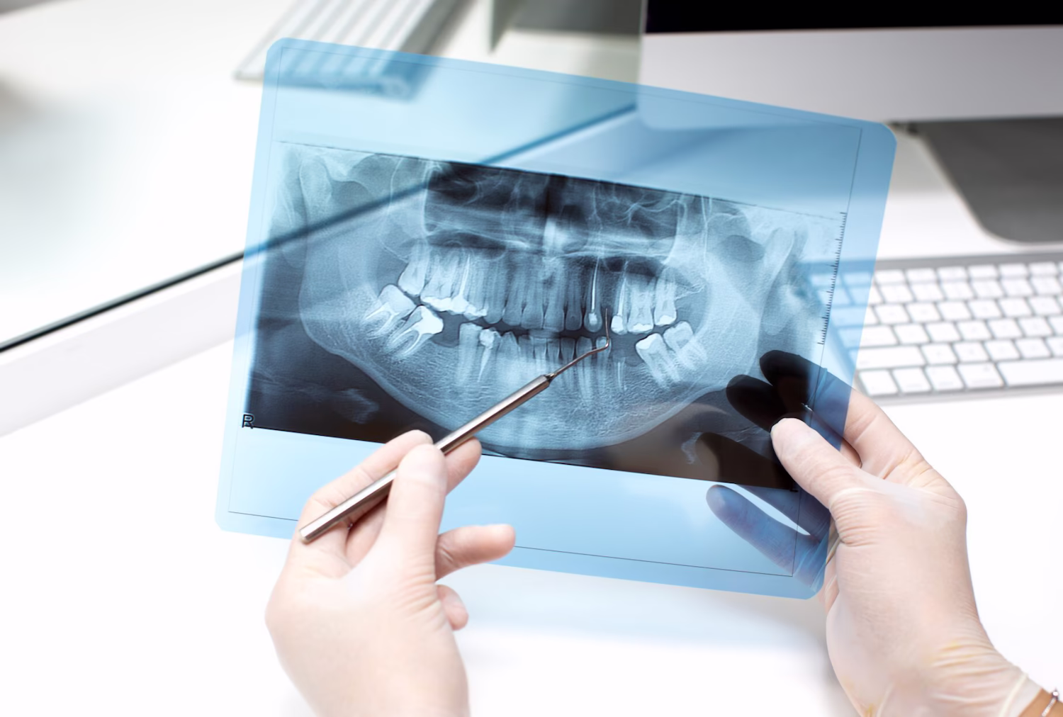 Bone grafting at Seaview Dental in Eatontown, NJ