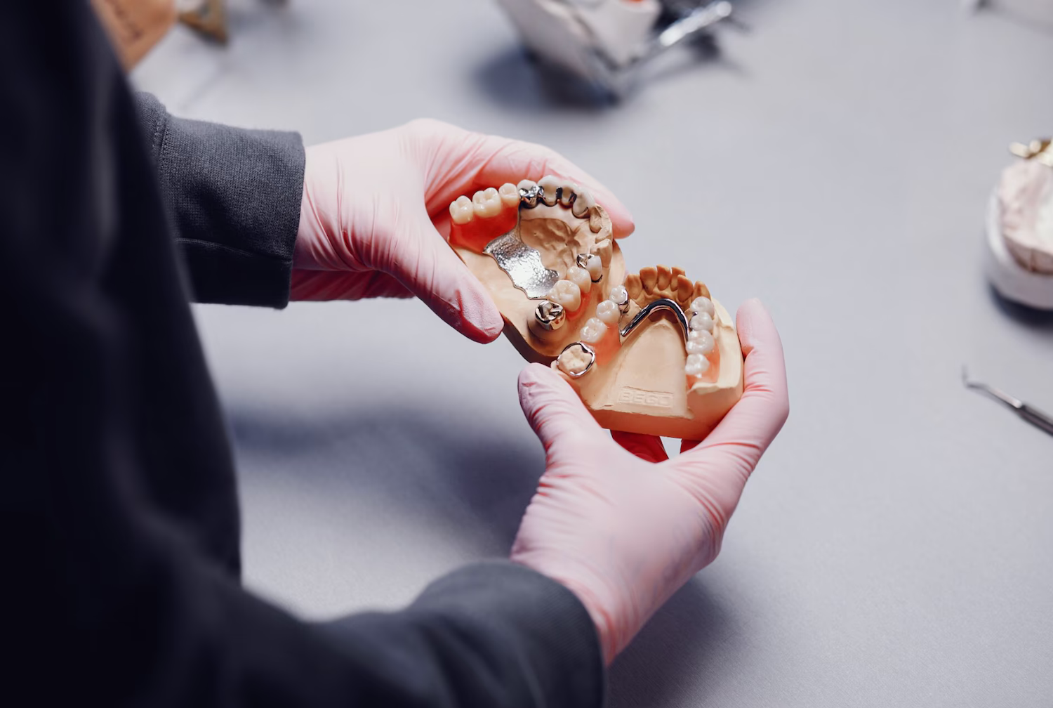 Dentist holding a dental model with a partial denture