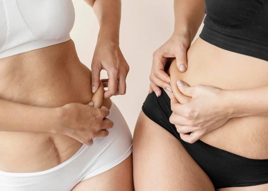 Laser lipo body sculpting session at Transformare Bellezza in East Hanover, NJ