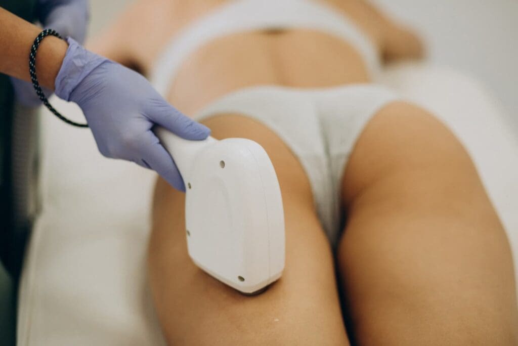 Venus Legacy skin tightening treatment at Transformare Bellezza