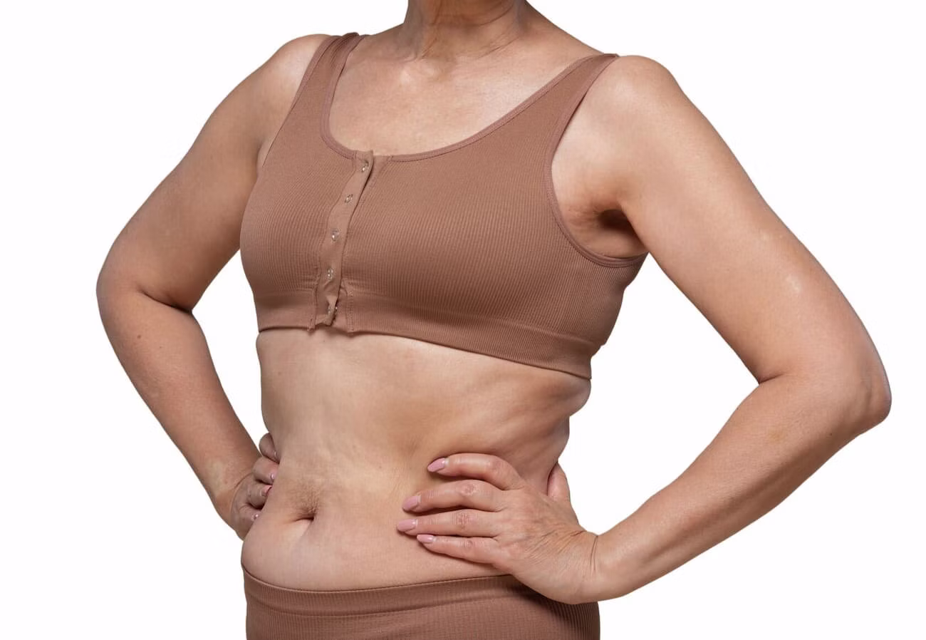 Toned midsection after non-surgical skin tightening