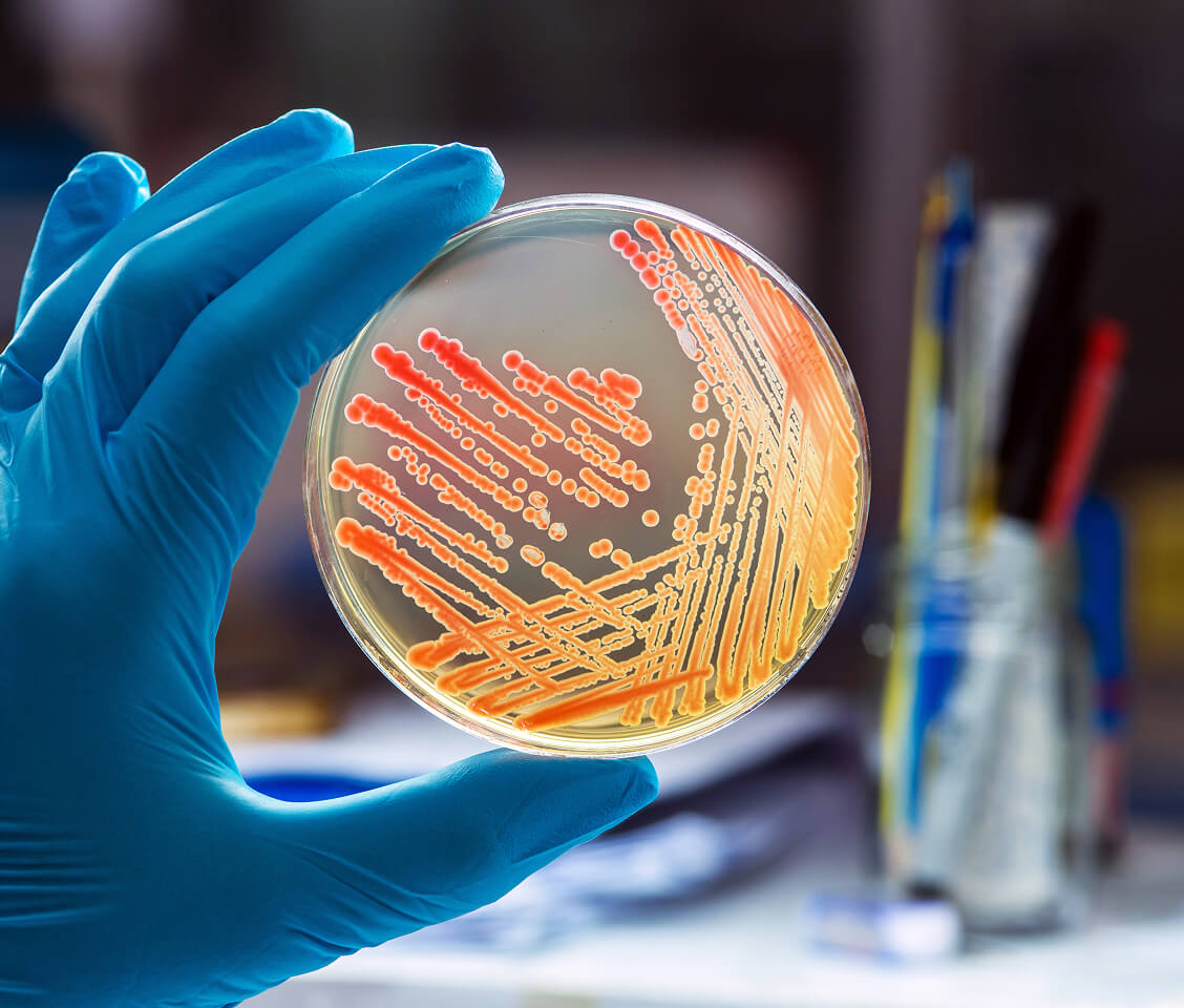Gloved hand holding a petri dish with orange bacterial colonies growing on the agar surface.